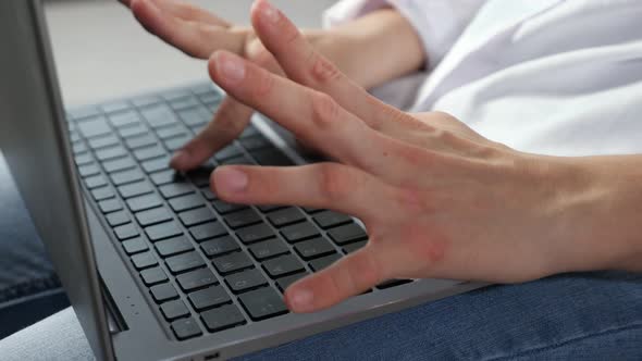 Disabled Woman Hardly Types Text on Laptop Working at Home