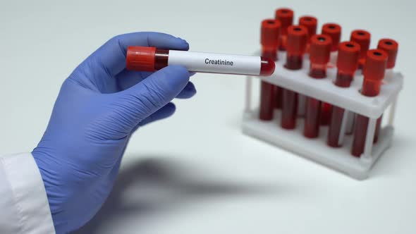 Creatinine, Doctor Showing Blood Sample in Tube, Lab Research, Health Checkup