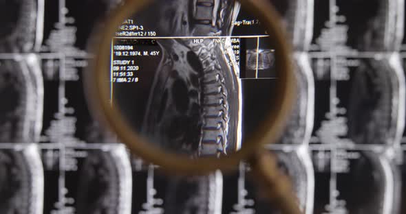 MRI Lumbar Spine Background Magnetic Resonance Tomography