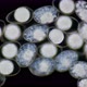 Eggs Mollusca Nudibranchia under a microscope, possibly Superfamily Fionoidea - VideoHive Item for Sale