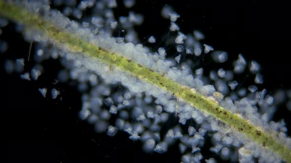 Infusoria Ciliophora Vorticella Under Microscope Class Oligohymenophorea
