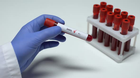 Negative SARS Test, Doctor Showing Blood Sample, Lab Research, Health Checkup