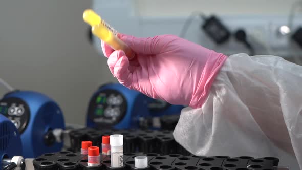 Blood Plasma Samples in Test Tubes on Vial Rack