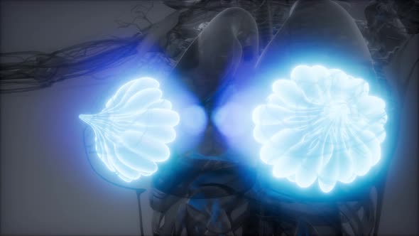 Medically Accurate Illustration of an Obese Womens Mammary Glands alt