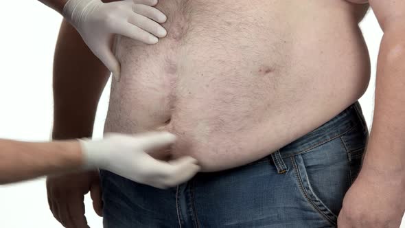 Doctor Examines a Belly of a Fat Man