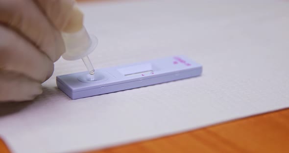 Closeup shot of doctor hand pressing drop test