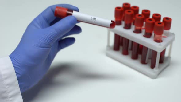 ESR Test, Doctor Showing Blood Sample in Tube, Lab Research, Health Checkup