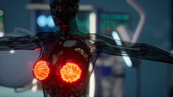 Medical Scan of Woman Breast alt