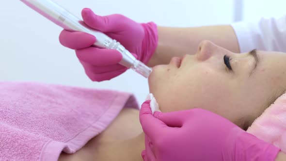The cosmetologist makes the procedure Microdermabrasion of the facial skin 