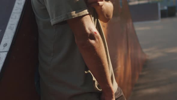 Close Up of Skater Looking at Injury