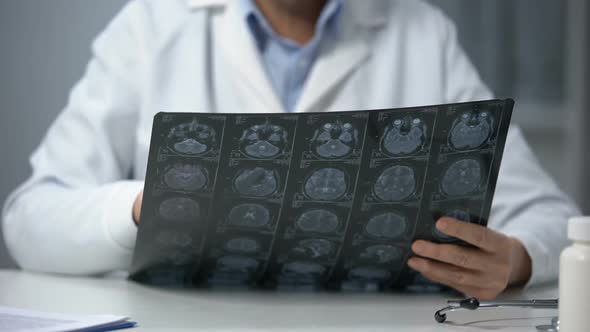 Female Doctor Analyzing Brain X-Ray and Shaking Head Displeased With Scan Result