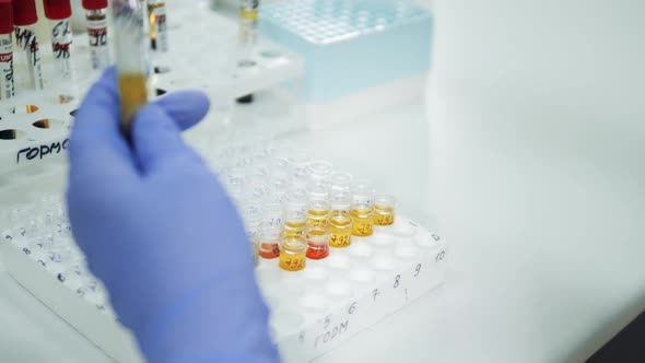 A Person Works with Samples in Laboratory. Covid-19 Test, Covid-19 Vaccination Concept.