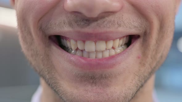 Close Up of Mouth of Smiling Young Man