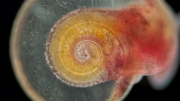 Snail Family Planorbidae under microscope, order Pulmonata. Possibly species Anisus sp