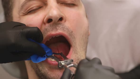 A man treats the teeth of a woman doctor, a dentist's job in the office, healthy teeth