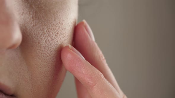 Skin Texture with Enlarged Pores