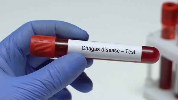 Chagas Disease-Test, Doctor Holding Blood Sample in Tube Close-Up, Health
