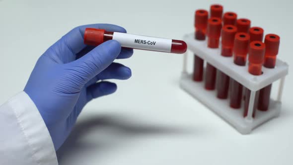 MERS-CoV, Doctor Showing Blood Sample in Tube, Lab Research, Health Checkup