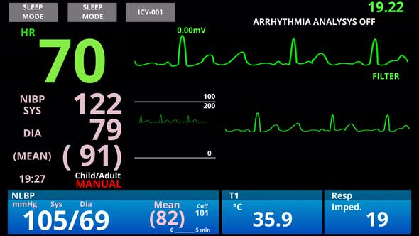 Medical Vital Signs Monitor, Cardio Sensor Patient Health Condition Diagnostic