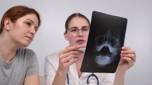A Woman Doctor and a Patient at the Reception are Discussing an Xray of the Sinuses