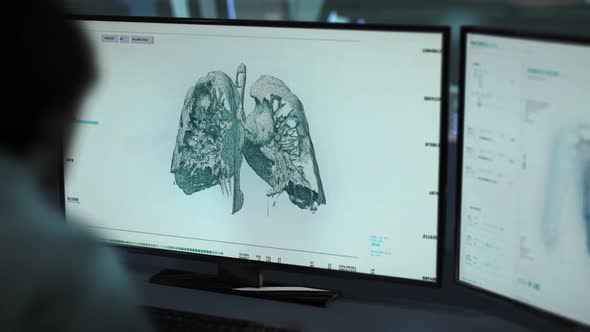 Surgery Doctor Monitoring Lung Health Condition At Futuristic Laboratory alt