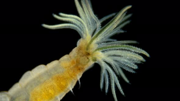 Worm Manayunkia Baicalensis Under a Microscope, of the Family Fabriciidae