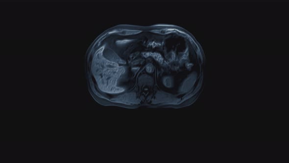 Voluminous Color CT Scan of the Abdomen