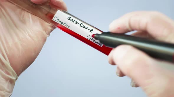 The Virologist is Holding a Test Tube with a Blood Sample Infected with a Coronovirus