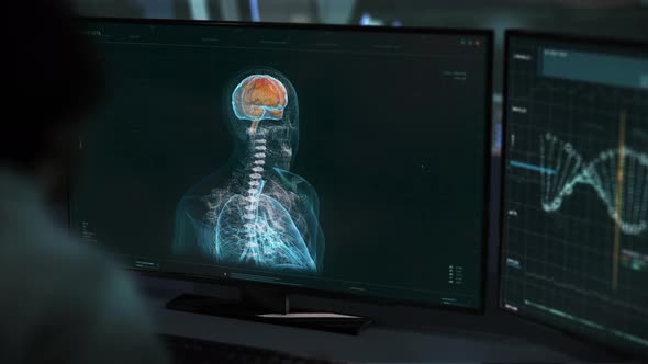 Patients Brain Anatomy Diagnosis Via Rotating Interface Computer System alt