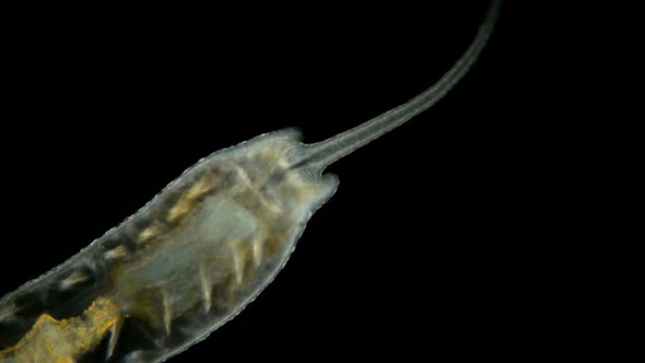 Worm of the Family Naididae Under a Microscope