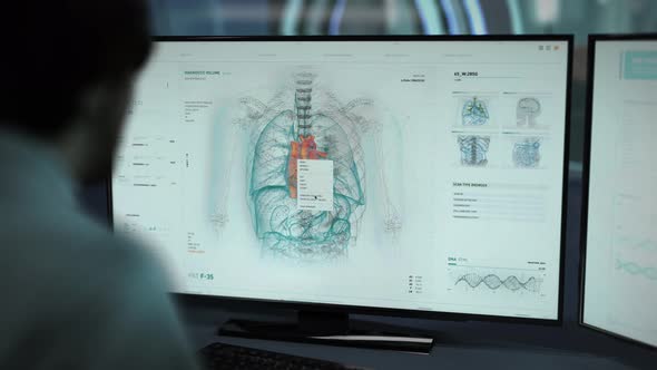 Visualization Of Skeleton In Scanner Interface Used For Examination Of Heart alt