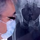 Doctor Orthopedic Close Up On X Ray - VideoHive Item for Sale