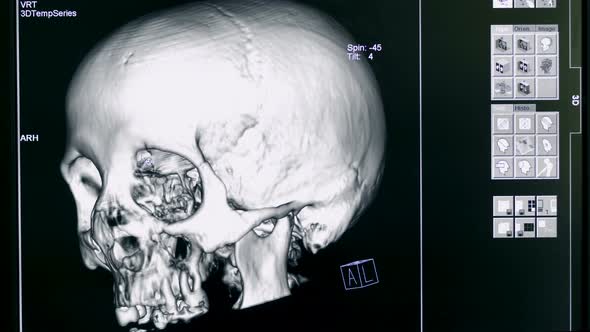 Close Up of a 3D Model of a Human Brain on a Display