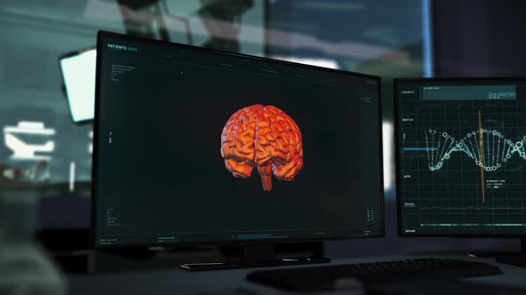 Detailed Brain Research Focusing On A Tumor Via High Tech Computer Program alt