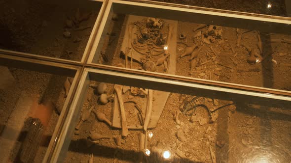 Human Bones in Showcase