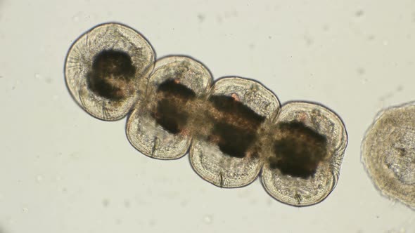 Egg, Cocoon of the Worm Tubifex Tubifex