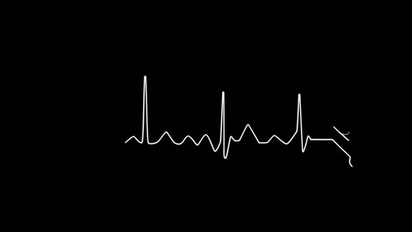 Abstract seamless line heartbeat. 4k video animation of pulse heart rhythm. Video animation