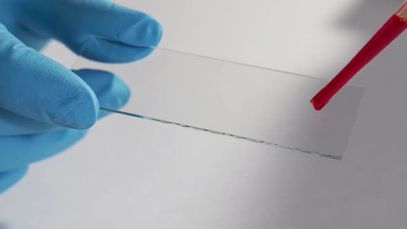 Lab Technician Performs a Blood Test in the Laboratory