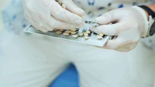 The dentist selects the right shade of the tooth on a Vitascale. Palette for tooth color.