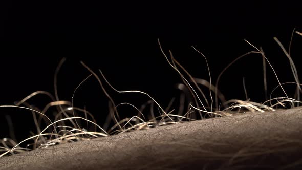 Goosebumps Close Up. Hair on His Hand Stand Up. Static Electricity. Light Fall on the Body of the