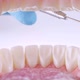 Dentist Inspects Teeth with Probe and Mirror - VideoHive Item for Sale