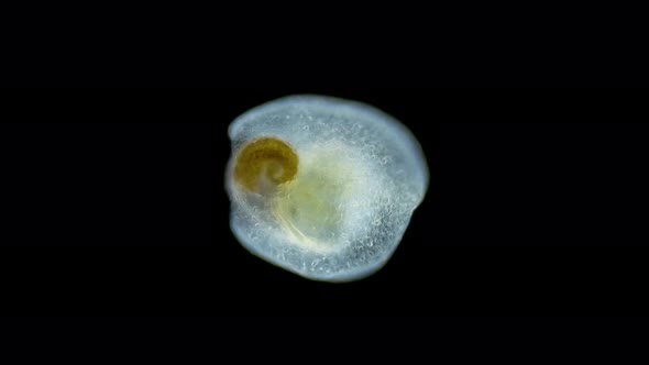 Acoela Worm Convolutriloba Under a Microscope Turbellaria Type Xenacoelomorpha