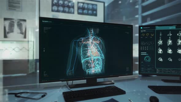 Medical x-ray examination computer software is inspecting the human skeleton alt