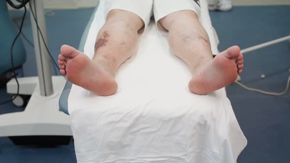 Patient with Frostbite Leg Lies on an Operating Table in Hospital