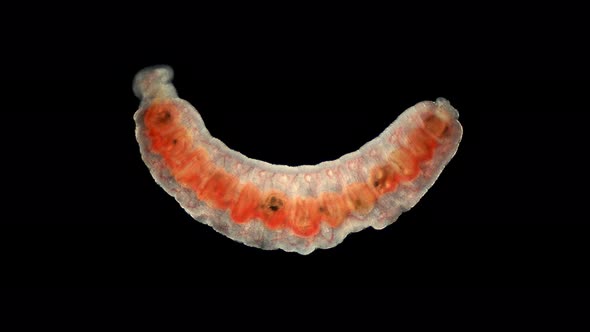 Oligochaeta Worm Under a Microscope, Type Annelida, Sample Found at Lake Baikal