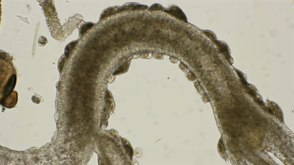 The Infusion of Trichodin and Kerona Polyporum on the Body of Hydra, Which are Commensals, Under a alt