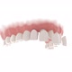 Dental Veneers - VideoHive Item for Sale