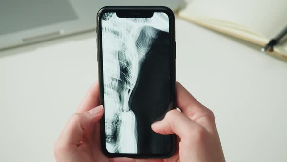 Doctor Veterinarian Examining Bird Skeleton Roentgen Closeup