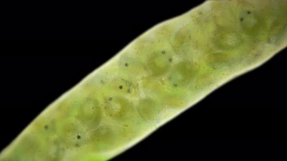 Cocoon with Eggs and Larvae Water Mites Hydrachnidia Under a Microscope Arrenuridae Family