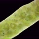 Cocoon with Eggs and Larvae Water Mites Hydrachnidia Under a Microscope Arrenuridae Family - VideoHive Item for Sale